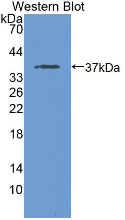 Polyclonal Antibody to NADH Dehydrogenase 1 (ND1)