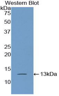 Polyclonal Antibody to Poly A Binding Protein Cytoplasmic 1 Like Protein (PABPC1L)