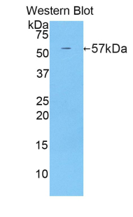 Polyclonal Antibody to CUB And Zona Pellucida Like Domains Protein 1 (CUZD1)