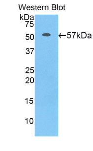 Polyclonal Antibody to CUB And Zona Pellucida Like Domains Protein 1 (CUZD1)