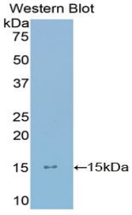 Polyclonal Antibody to Ly1 Antibody Reactive Homolog (LYAR)