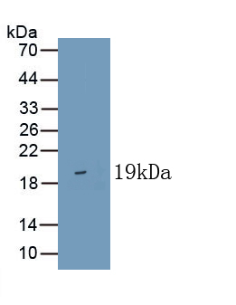 Polyclonal Antibody to Mucin (MUC)