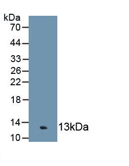 Polyclonal Antibody to Complement Component 4c (C4c)