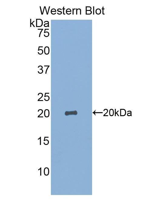 Polyclonal Antibody to Sialic Acid Binding Ig Like Lectin 14 (SIGLEC14)