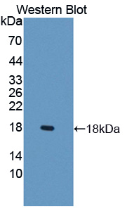 Polyclonal Antibody to Lipocalin Like Protein 1 (LCNL1)