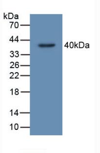 Polyclonal Antibody to TP53 Target Gene 5 (TP53TG5)