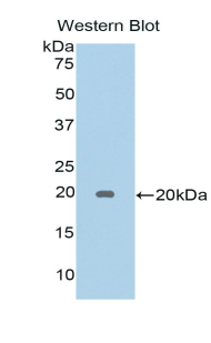 Polyclonal Antibody to Galectin 5 (GAL5)