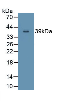 Polyclonal Antibody to NADH Dehydrogenase 5 (ND5)