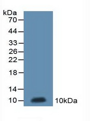 Polyclonal Antibody to NADH Dehydrogenase 5 (ND5)