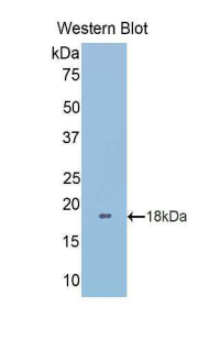 Polyclonal Antibody to Galectin 9B (GAL9B)
