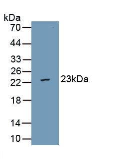 Polyclonal Antibody to Von Willebrand Factor A Domain Containing Protein 5B2 (vWA5B2)