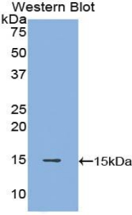 Polyclonal Antibody to POTE Ankyrin Domain Family, Member J (POTEJ)