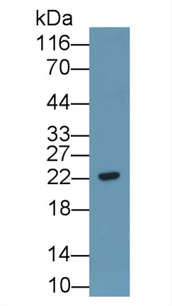 Polyclonal Antibody to Coxsackie And Adenovirus Receptor Like Membrane Protein (CLMP)