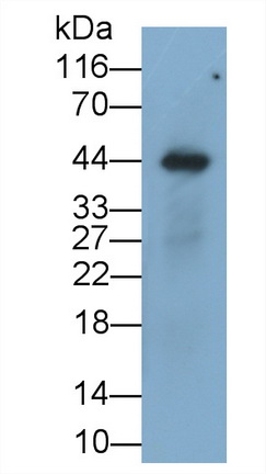 Recombinant Antibody to Transforming Growth Factor Beta 1 (TGFb1)