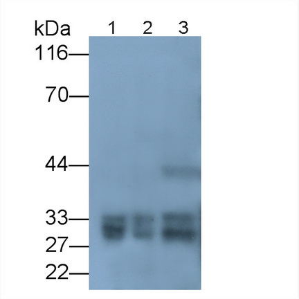 Recombinant Antibody to Cardiac Troponin I (cTnI)