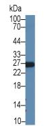 Recombinant Antibody to Apolipoprotein A1 (APOA1)