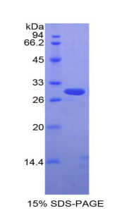 Recombinant Activated Leukocyte Cell Adhesion Molecule (ALCAM)