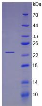 Recombinant Angiopoietin 1 (ANGPT1)