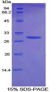 Recombinant Angiopoietin 2 (ANGPT2)