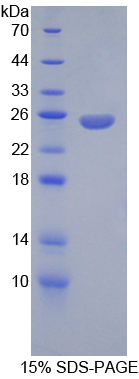 Recombinant Angiopoietin 2 (ANGPT2)