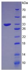 Recombinant Angiopoietin 2 (ANGPT2)