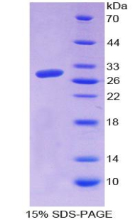 Recombinant Connective Tissue Growth Factor (CTGF)