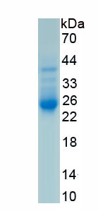 Recombinant Connective Tissue Growth Factor (CTGF)