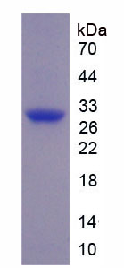 Recombinant Connective Tissue Growth Factor (CTGF)