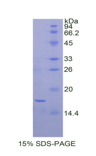 Recombinant Brain Derived Neurotrophic Factor (BDNF)