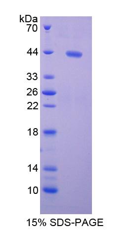 Recombinant Brain Derived Neurotrophic Factor (BDNF)