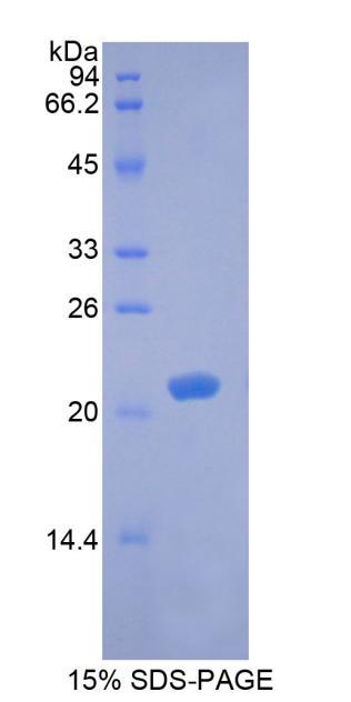 Recombinant Brain Derived Neurotrophic Factor (BDNF)