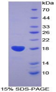 Recombinant Bone Morphogenetic Protein Receptor 2 (BMPR2)