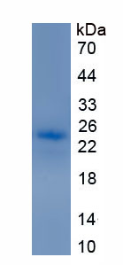 Recombinant Chemokine C-Motif Receptor 1 (XCR1)
