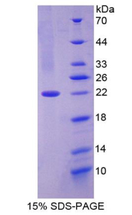 Recombinant Ciliary Neurotrophic Factor (CNTF)