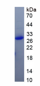 Recombinant Endocrine Gland Derived Vascular Endothelial Growth Factor (EG-VEGF)