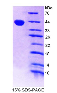 Recombinant Eosinophil Chemotactic Factor (ECF)