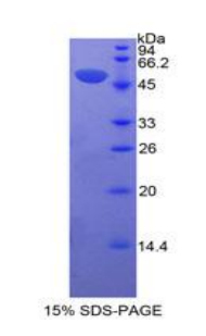 Recombinant Erythropoietin Receptor (EPOR)