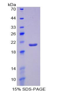 Recombinant Erythropoietin (EPO)