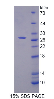 Recombinant E-selectin