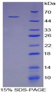 Recombinant E-selectin