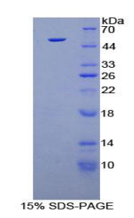 Recombinant Fibroblast Growth Factor 1, Acidic (FGF1)