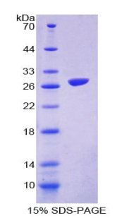 Recombinant FMS Like Tyrosine Kinase 3 (Flt3)