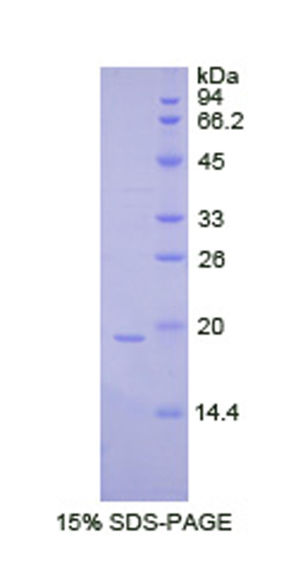 Recombinant Colony Stimulating Factor 3, Granulocyte (GCSF)