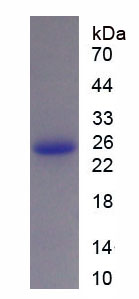 Recombinant Growth Hormone (GH)