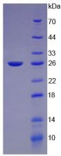 Recombinant Growth Hormone (GH)