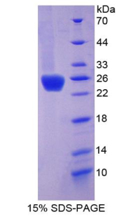 Recombinant Growth Hormone (GH)