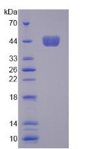 Recombinant Colony Stimulating Factor 2, Granulocyte Macrophage (GM-CSF)