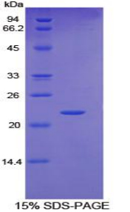 Recombinant Glycoprotein 130 (gp130)