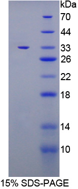 Recombinant Glycoprotein 130 (gp130)