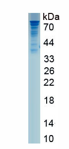 Recombinant Hepatocyte Growth Factor (HGF)